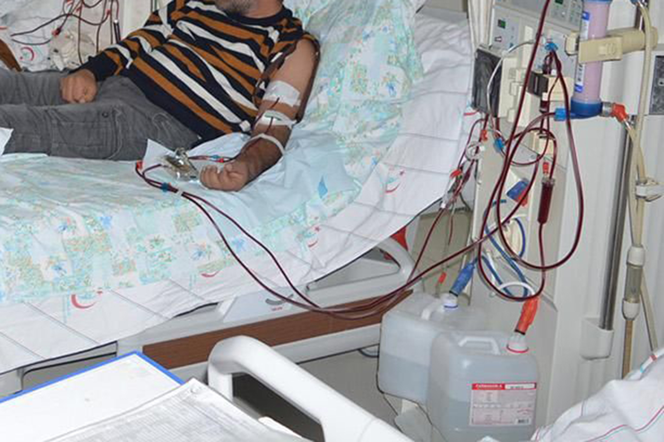 Diyalizde tehlike içeren 3 besin Diyalizde tehlike içeren 3 besin